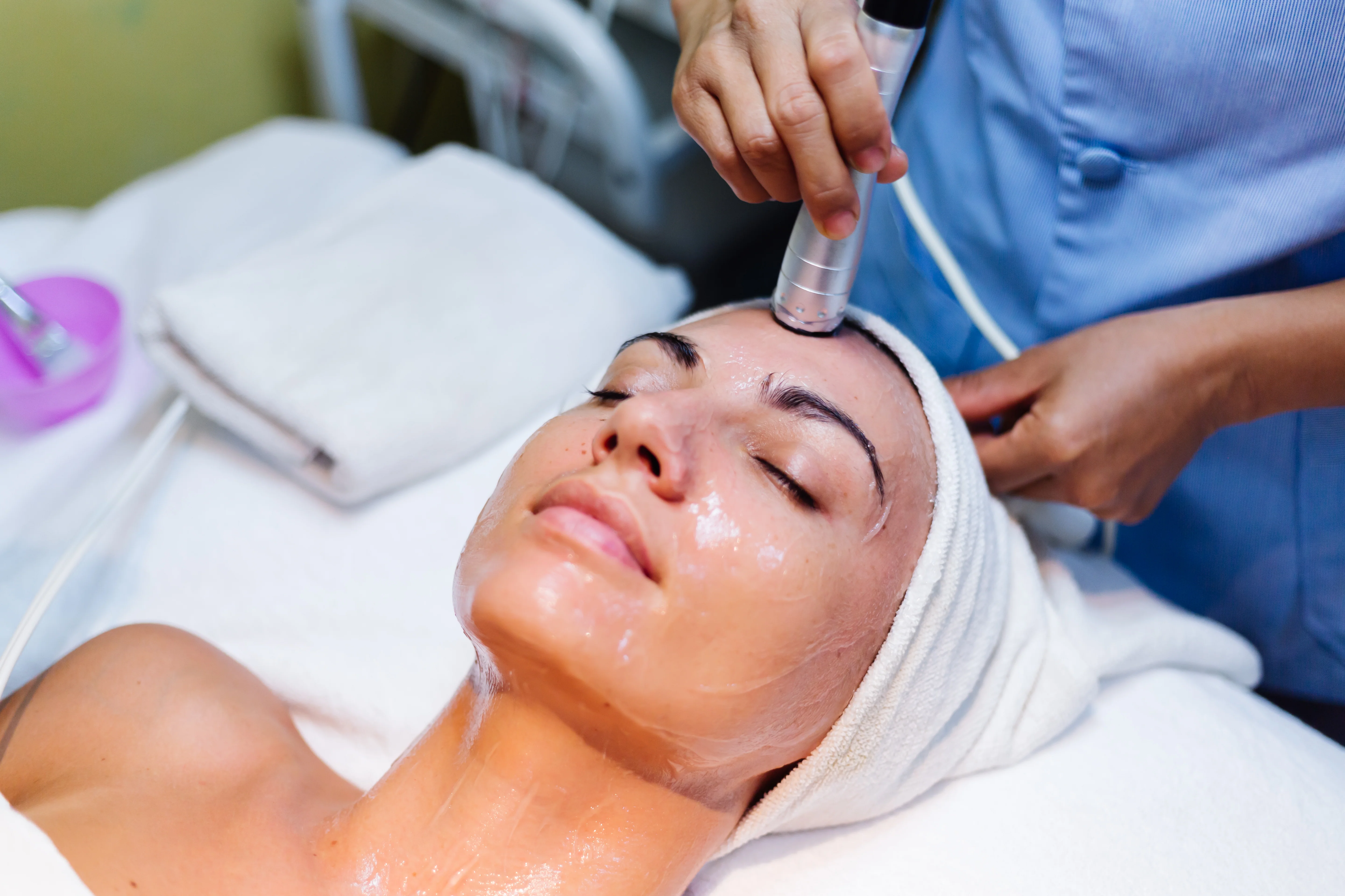 Chemical Peels