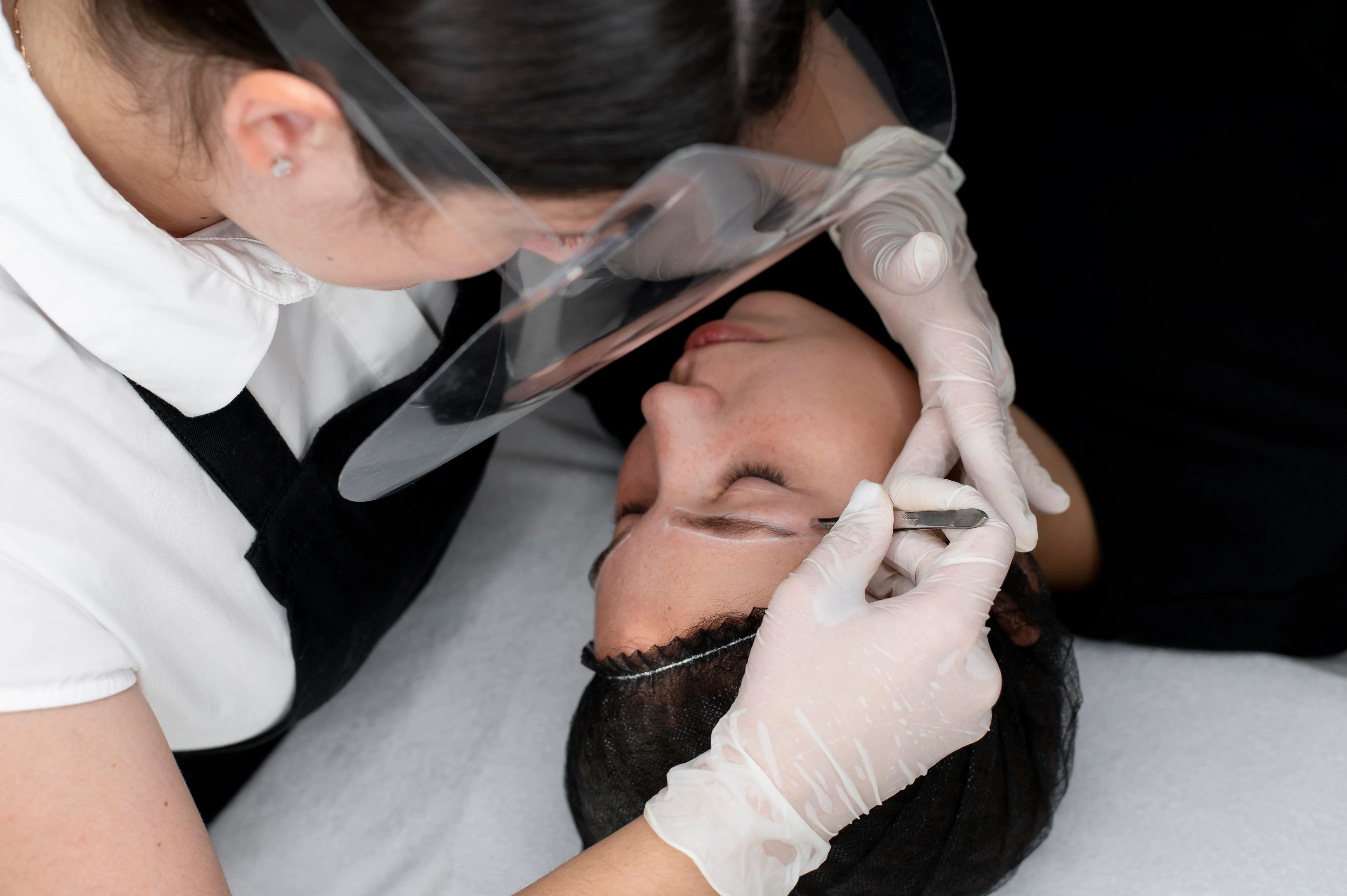 Morpheus8 Microneedling
